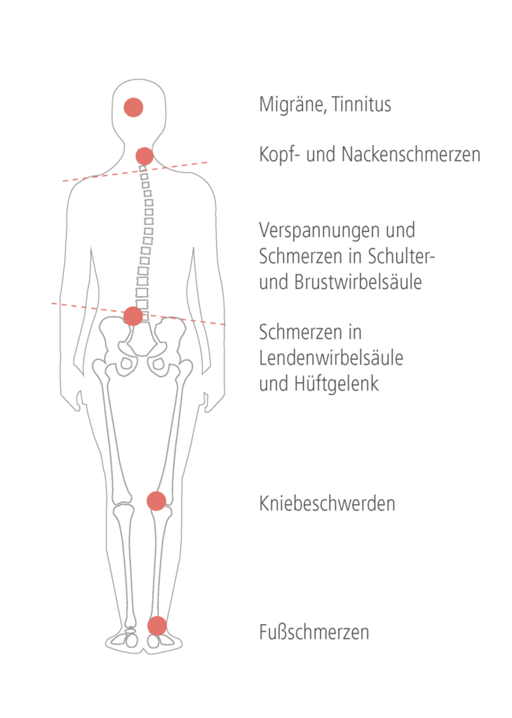 Grafische Darstellung eines menschlichen Körpers, welche die verschiedenen Symptome von CMD illustriert.